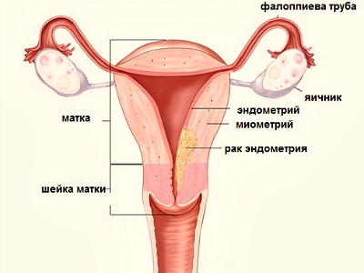 Запах крови при менструации